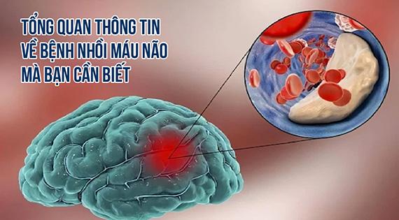 Cwin9000 phiên bản mới-ID-5-ra-mat